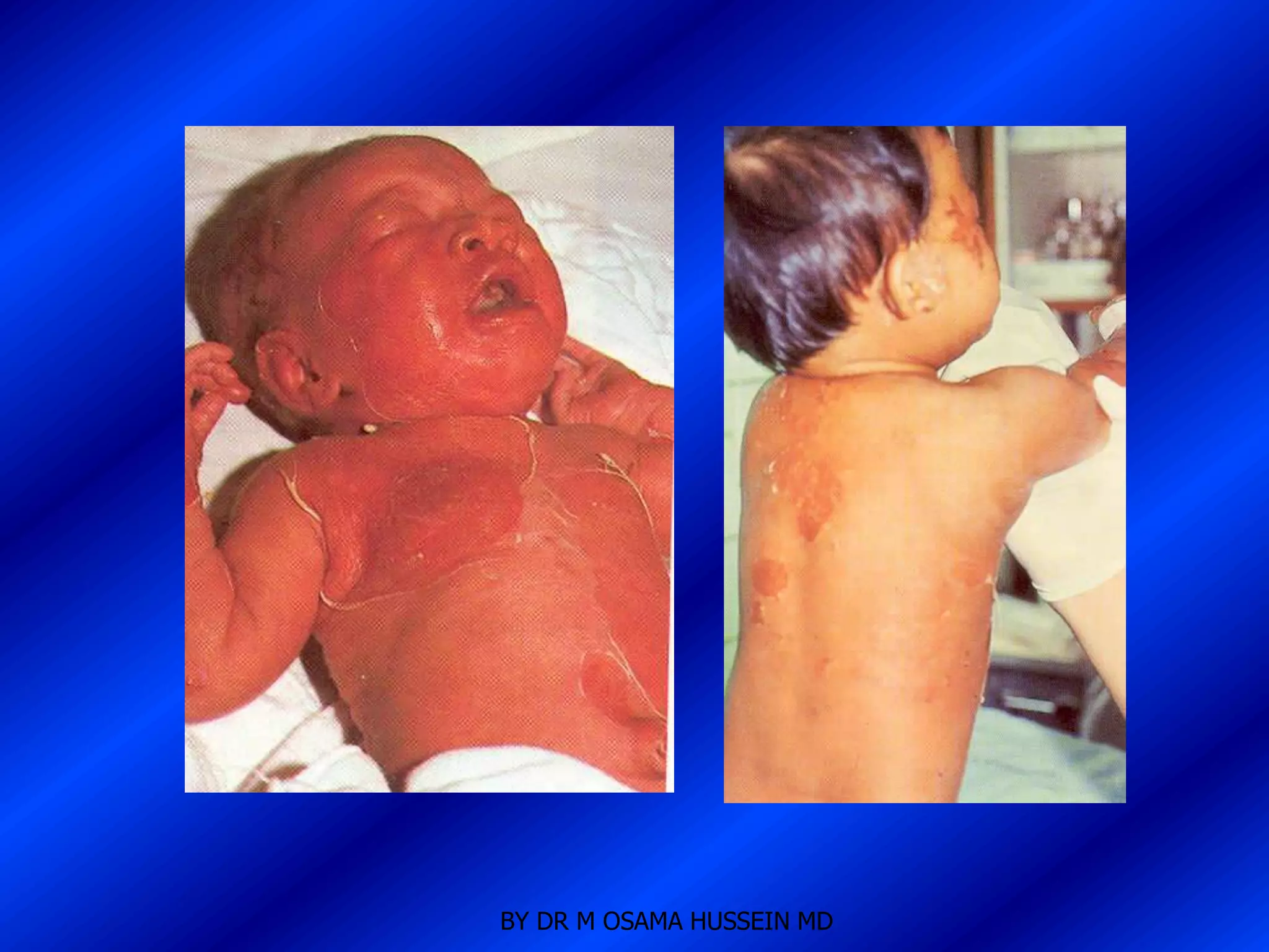 BY DR M OSAMA HUSSEIN MD
 