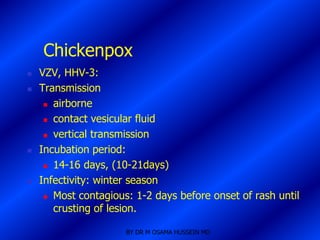 Chickenpox
   VZV, HHV-3:
   Transmission
      airborne

      contact vesicular fluid

      vertical transmission

   Incubation period:
      14-16 days, (10-21days)

   Infectivity: winter season
      Most contagious: 1-2 days before onset of rash until

       crusting of lesion.

                      BY DR M OSAMA HUSSEIN MD
 