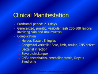Clinical Manifestation
   Prodromal period: 2-3 days
   Generalized, pruritic, vesicular rash 250-500 lesions
    involving skin and oral mucosa
   Complication
      Herpes Zoster, Shingles

      Congenital varicella: Scar, limb, ocular, CNS defect

      Bacterial infection

      Severe chickenpox

      CNS: encephalitis, cerebellar ataxia, Reye’s

       Syndrome

                   BY DR M OSAMA HUSSEIN MD
 