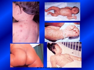 BY DR M OSAMA HUSSEIN MD
 