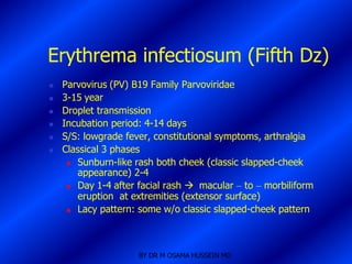Erythrema infectiosum (Fifth Dz)
   Parvovirus (PV) B19 Family Parvoviridae
   3-15 year
   Droplet transmission
   Incubation period: 4-14 days
   S/S: lowgrade fever, constitutional symptoms, arthralgia
   Classical 3 phases
      Sunburn-like rash both cheek (classic slapped-cheek
       appearance) 2-4
      Day 1-4 after facial rash  macular – to – morbiliform
       eruption at extremities (extensor surface)
      Lacy pattern: some w/o classic slapped-cheek pattern




                     BY DR M OSAMA HUSSEIN MD
 