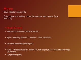 Reiter Node Pyrexia of unkown origin by Dr mohammed Hussien | PPT