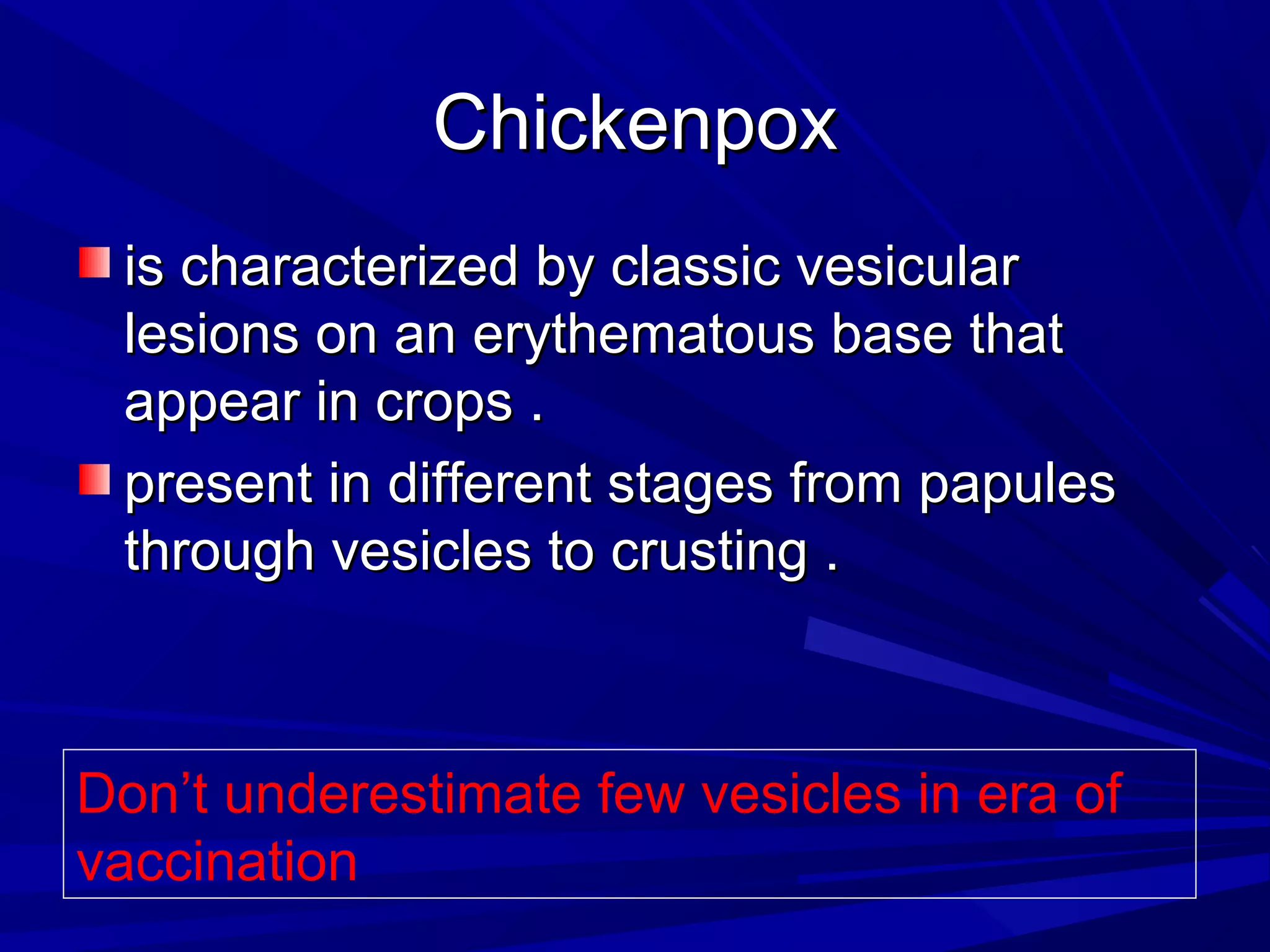 Chickenpox
is characterized by classic vesicular
lesions on an erythematous base that
appear in crops .
present in different stages from papules
through vesicles to crusting .

Don’t underestimate few vesicles in era of
vaccination

 
