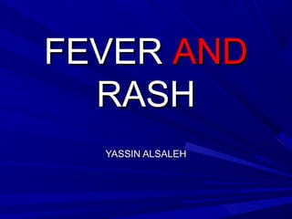 FEVER AND
RASH
YASSIN ALSALEH

 