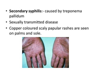 Treponema Rash Fever and rash | PPTX