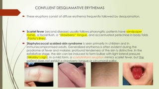 Approach to a patient with Fever And Rash.pptx