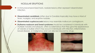 Diffuse Nodular Rash Approach to a patient with Fever And Rash.pptx