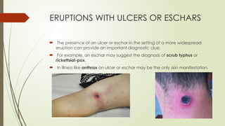 Approach to a patient with Fever And Rash.pptx