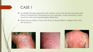 Approach to a patient with Fever And Rash.pptx