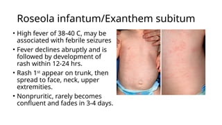 Fever and skin rash - Approach.pptxBy Dr Gururaja R , Paediatrician. An ...