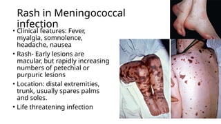 Fever and skin rash - Approach.pptxBy Dr Gururaja R , Paediatrician. An ...