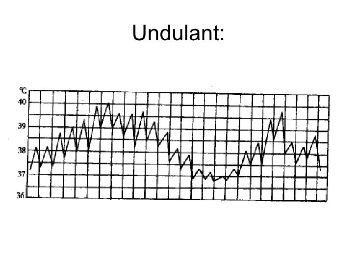 Unkulant Unkulant