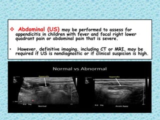  Abdominal (US) may be performed to assess for
appendicitis in children with fever and focal right lower
quadrant pain or abdominal pain that is severe.
• However, definitive imaging, including CT or MRI, may be
required if US is nondiagnostic or if clinical suspicion is high.
 