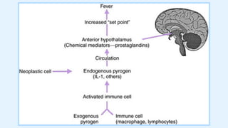 Comprehensive Overview of Fever of Unknown Origin: Causes, Diagnosis ...