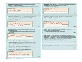 fever ppt.pptx
