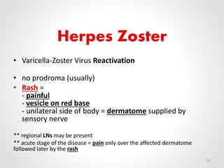 Herpes Zoster
• Varicella-Zoster Virus Reactivation
• no prodroma (usually)
• Rash =
- painful
- vesicle on red base
- unilateral side of body = dermatome supplied by
sensory nerve
** regional LNs may be present
** acute stage of the disease = pain only over the affected dermatome
followed later by the rash
35
 