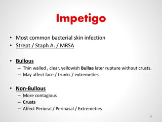 Impetigo
• Most common bacterial skin infection
• Strept / Staph A. / MRSA
• Bullous
– Thin walled , clear, yellowish Bullae later rupture without crusts.
– May affect face / trunks / extremeties
• Non-Bullous
– More contagious
– Crusts
– Affect Perioral / Perinasal / Extremeties
38
 