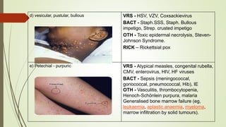 Cmv Pustular Rash Fever & Rash | PPTX