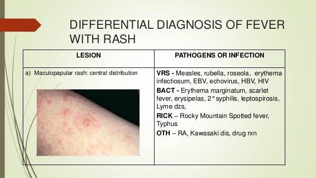 Fever And Rash