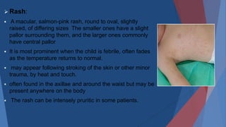 Fever,Rash and.pptx