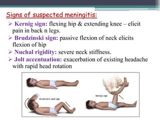 Approach to a case of Fever with altered sensorium PPTX Brain and