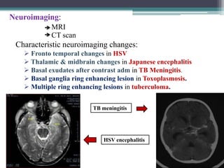 Neuroimaging:
MRI
CT scan

Characteristic neuroimaging changes:
 Fronto temporal changes in HSV
 Thalamic & midbrain changes in Japanese encephalitis
 Basal exudates after contrast adm in TB Meningitis.
 Basal ganglia ring enhancing lesion in Toxoplasmosis.
 Multiple ring enhancing lesions in tuberculoma.
TB meningitis

HSV encephalitis

 
