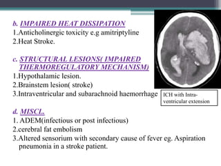 b. IMPAIRED HEAT DISSIPATION
1.Anticholinergic toxicity e.g amitriptyline
2.Heat Stroke.
c. STRUCTURAL LESIONS( IMPAIRED
THERMOREGULATORY MECHANISM)
1.Hypothalamic lesion.
2.Brainstem lesion( stroke)
3.Intraventricular and subarachnoid haemorrhage

ICH with Intraventricular extension

d. MISCL.
1. ADEM(infectious or post infectious)
2.cerebral fat embolism
3.Altered sensorium with secondary cause of fever eg. Aspiration
pneumonia in a stroke patient.

 