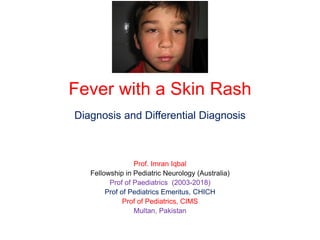 Fever with a Skin Rash
Diagnosis and Differential Diagnosis
Prof. Imran Iqbal
Fellowship in Pediatric Neurology (Australia)
Prof of Paediatrics (2003-2018)
Prof of Pediatrics Emeritus, CHICH
Prof of Pediatrics, CIMS
Multan, Pakistan
 