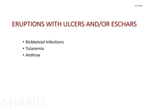 ERUPTIONS WITH ULCERS AND/OR ESCHARS
• Rickketsial Infections
• Tularemia
• Anthrax
Dr N Anand
ANAND
 