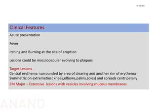 Clinical Features
Acute presentation
Fever
Itching and Burning at the site of eruption
Lesions could be maculopapular evolving to plaques
Target Lesions
Central erythema  surrounded by area of clearing and another rim of erythema
Symmetric on extremeties( knees,elbows,palms,soles) and spreads centripetally
EM Major – Extensive  lesions with vesicles involving mucous membranes 
Dr N Anand
ANAND
 