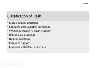 Classification of  Rash
• Maculopapular Eruptions
• Confluent Desquamative Erythemas
• Vesiculobullous or Pustular Eruptions
• Urticaria like eruptions
• Nodular Eruptions
• Purpuric Eruptions
• Eruptions with Ulcers or Eschars
Dr N Anand
ANAND
 