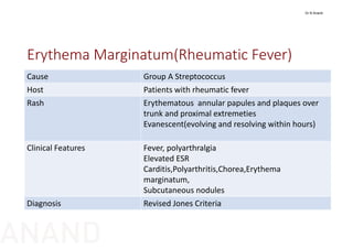 Erythema Marginatum(Rheumatic Fever)
Cause Group A Streptococcus
Host Patients with rheumatic fever
Rash Erythematous  annular papules and plaques over 
trunk and proximal extremeties
Evanescent(evolving and resolving within hours)
Clinical Features Fever, polyarthralgia
Elevated ESR
Carditis,Polyarthritis,Chorea,Erythema
marginatum,
Subcutaneous nodules
Diagnosis Revised Jones Criteria
Dr N Anand
ANAND
 