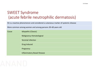 SWEET Syndrome
(acute febrile neutrophilic dermatosis)
SS is a reactive phenomenon and considered a cutaneous marker of systemic disease
More common among women and among persons 30–60 years old
Cause Idiopathic (Classic)
Malignancy‐Hematological
Yersinial infection 
Drug Induced
Pregnancy
Inflammatory Bowel Disease
Dr N Anand
ANAND
 