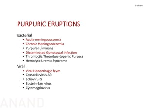 PURPURIC ERUPTIONS
Bacterial
• Acute meningococcemia
• Chronic Meningococcemia
• Purpura Fulminans
• Disseminated Gonococcal Infection
• Thrombotic Thrombocytopenic Purpura
• Hemolytic Uremic Syndrome
Viral
• Viral Hemorrhagic fever
• Coxsackievirus A9
• Echovirus 9
• Epstein‐Barr virus
• Cytomegalovirus
Dr N Anand
ANAND
 