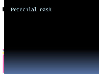 Petechial rash
 
