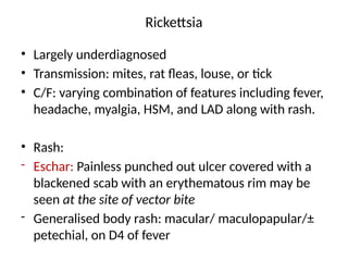 Ricketta Rash Fever with rash - Diagnosis and Treatment | PPTX