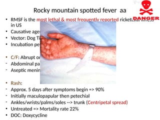 Rash Of Rmsf Fever with rash - Diagnosis and Treatment | PPTX