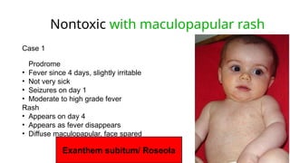 Pediatric Diffuse Rash Comprehensive Diagnostic Approach to Pediatric Fever with Rash ...