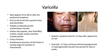 fever with rash a practical approach to fever | PPTX