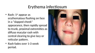Digrid Pattern Rash fever with rash a practical approach to fever | PPTX