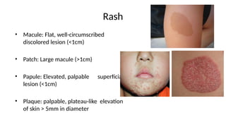 fever with rash a practical approach to fever | PPTX