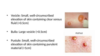 fever with rash a practical approach to fever | PPTX