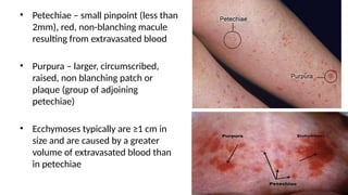 fever with rash a practical approach to fever | PPTX