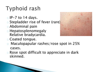 Fever with rashes | PPTX