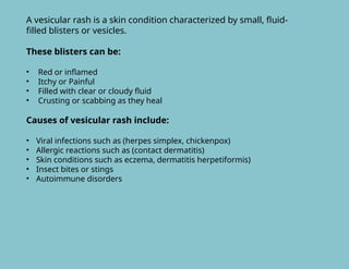 Fever with Rashes DIFFERENTIAL DIAGNOSIS | PPTX