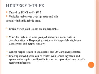 fever with rash final ppt and it's management.pptx