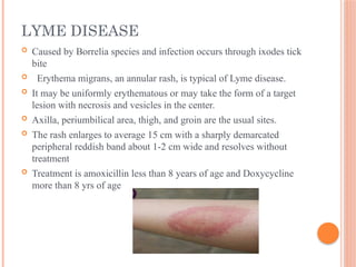 fever with rash final ppt and it's management.pptx