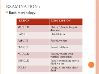 Exam Rash fever with rash final ppt and it's management.pptx