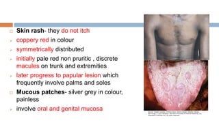 fever with rashfullfinal.pptx sms medical college | PPTX
