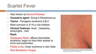 fever with rashfullfinal.pptx sms medical college | PPTX